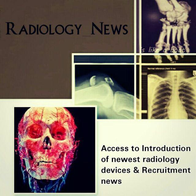رادیولوژی نیوز
